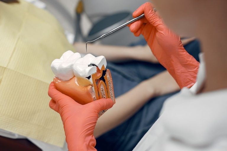¿Qué es la endodoncia?