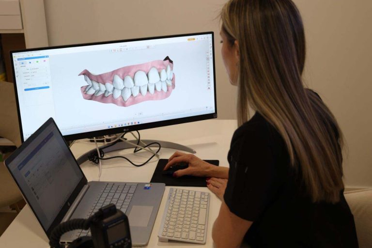 ¿Cuántos dientes tenemos?