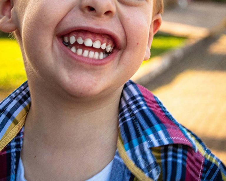 ¿Cuándo se caen los dientes de leche?