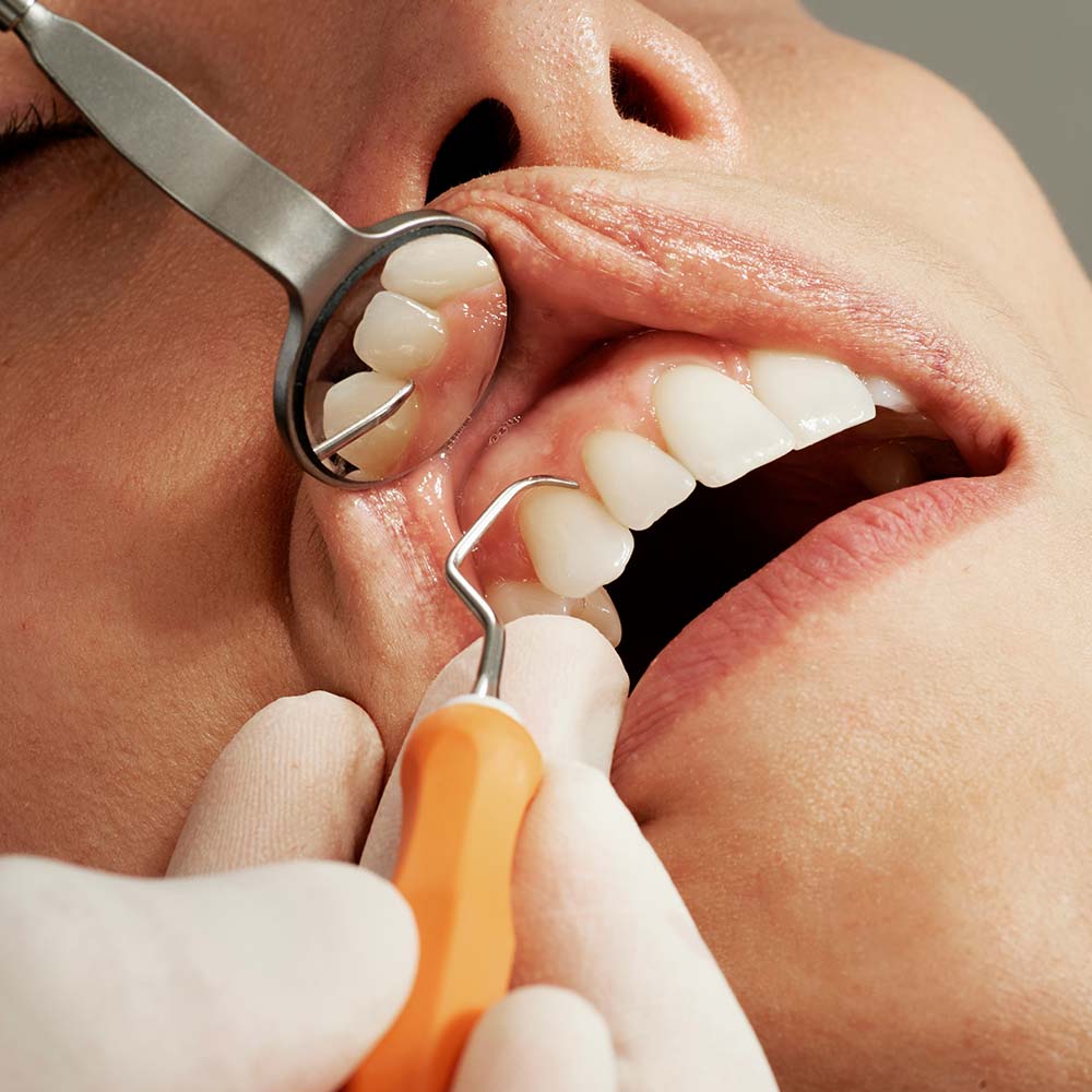 Dolor de muelas insoportable