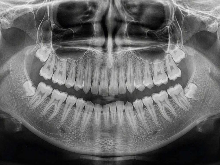 Radiografía dental
