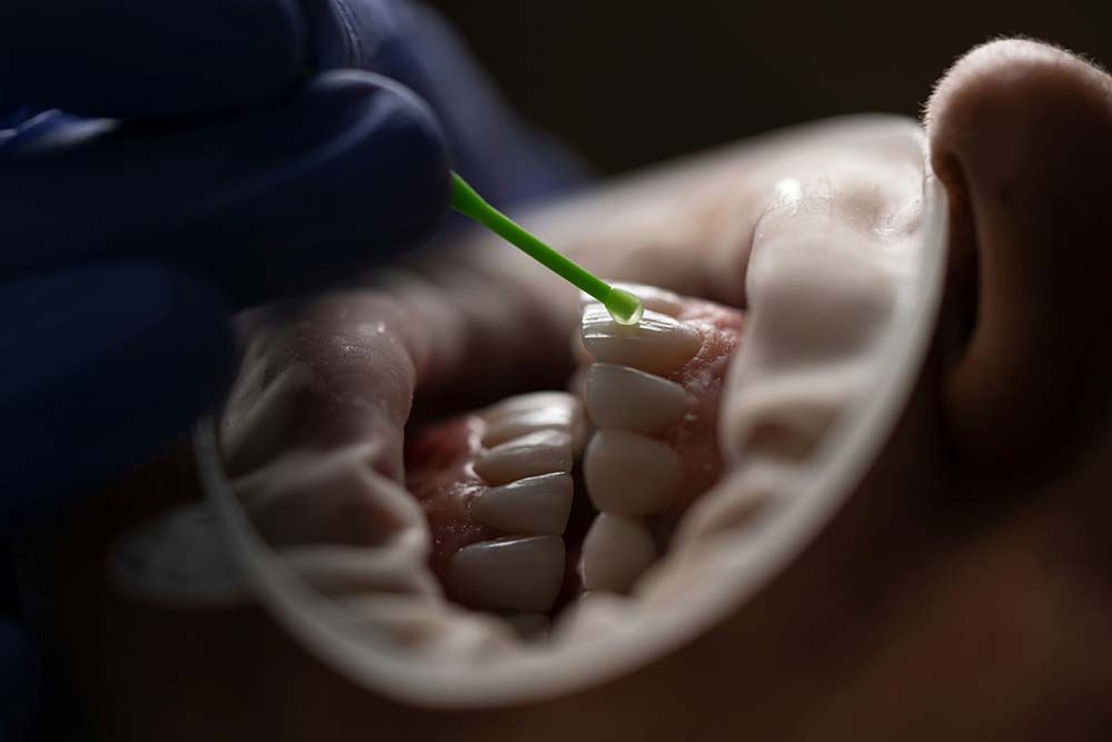 Limpieza dental